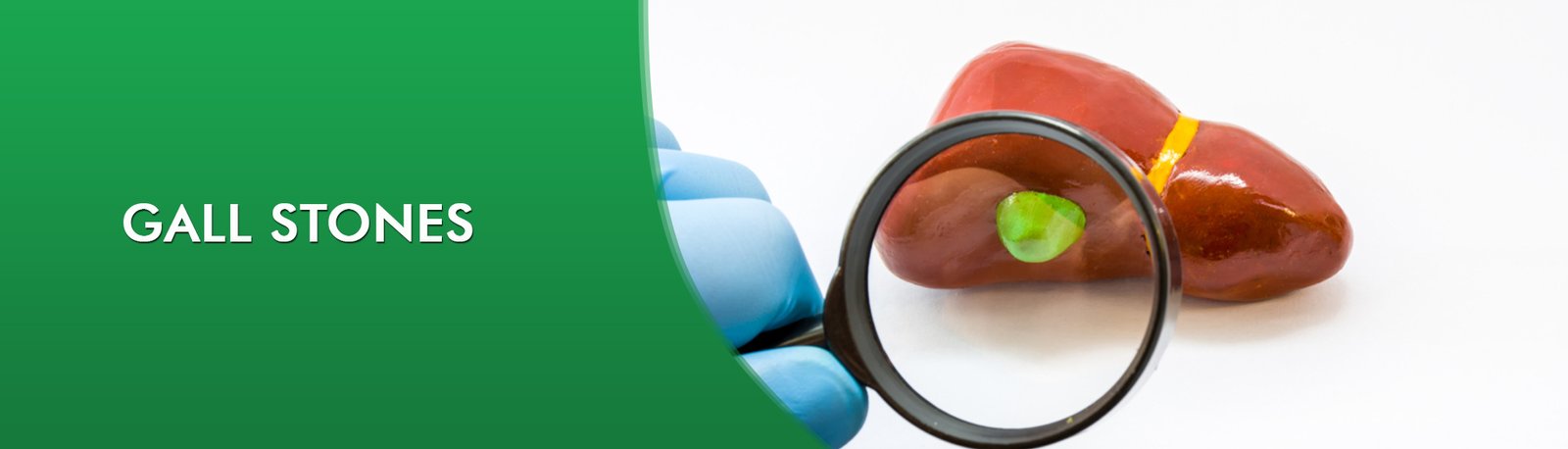 Ayurvedic treatment for Gall stones in Chennai