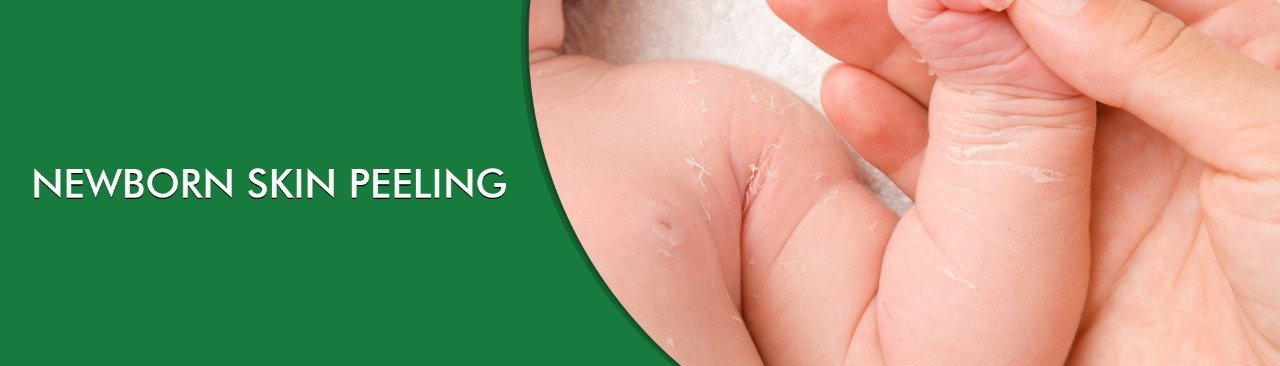 AYURVEDA TREATMENT FOR NEWBORN’S DRY AND PEELING SKIN